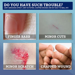 10ml eelhoe sıvı yara pansuman sıvı bant yardım mutfak bıçağı kesim aşınma yanık güneş yanığı yara bakımı jel - Product Image 4