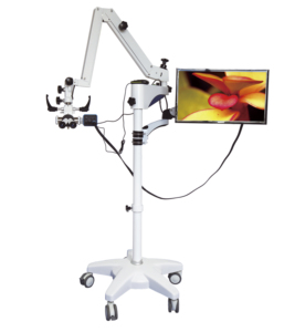 Microscopio Quirúrgico Oftálmico con Monitor LCD para Cirugía ENT, Microscopio Quirúrgico Móvil - Product Image 3