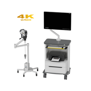 Chất lượng cao kỹ thuật số video điện tử 4k <span class=keywords><strong>colposcope</strong></span> máy với máy ảnh, CE chứng nhận cho phẫu thuật phụ khoa - Product Image 4