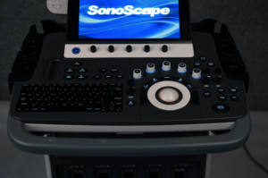 Slimme Sonoscape S50elite Medische Trolley 3d 4d 5d Echografie Machine Met Ai Functie Voor Obstetrische & Gynaecologie Diagnose - Product Image 6