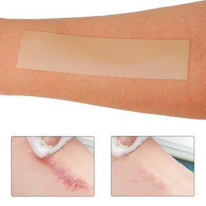 Gel Rimuovi Cicatrici Impermeabile, Cerotto Anti-Smagliature, Fogli di Silicone per Cicatrici da Acne, <span class=keywords><strong>Patch</strong></span> per Cicatrici con Etichetta Privata - Product Image 6