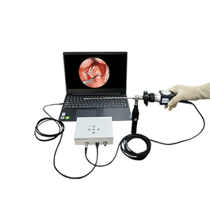 Mini <span class=keywords><strong>caméra</strong></span> <span class=keywords><strong>intelligente</strong></span> usb médicale, <span class=keywords><strong>caméra</strong></span> vidéo portable avec endoscope à 70 degrés - Product Image 1