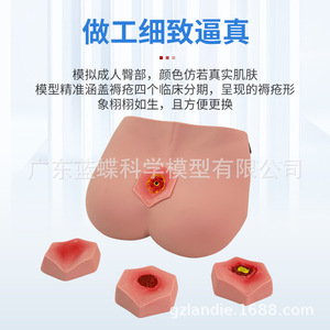 Modelo de cuidado de úlceras por presión por etapas, enseñanza de cuidado de ancianos, capacitación en el cuidado de úlceras por presión por etapas, cuidado de úlceras por presión - Product Image 1
