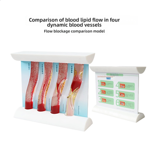 แบบจำลองหลอดเลือดแบบไดนามิก การเปรียบเทียบการอุดตันของคราบไขมันในหลอดเลือดแดงสำหรับการ<span class=keywords><strong>สอน</strong></span>ทางการแพทย์ - Product Image 6