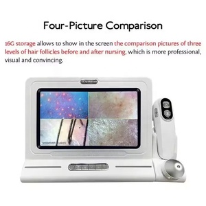 Detector de Análisis de Piel y Cuero Cabelludo con Pantalla Grande HD de Cuatro Espectros, 200 Aumentos, para Salón de Belleza, Depilación Corporal - Product Image 2
