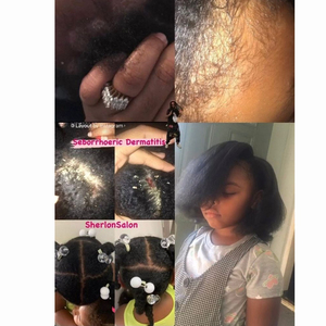 Shampoo <span class=keywords><strong>anti</strong></span>-<span class=keywords><strong>poux</strong></span>, traitement contre les <span class=keywords><strong>poux</strong></span>, défense quotidienne sans pesticide, shampooing <span class=keywords><strong>anti</strong></span>-<span class=keywords><strong>poux</strong></span> - Product Image 4