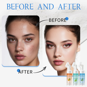 0.5% Bha Trà Cây Dầu Nghệ Kojic Axit Sáng Mặt Sữa Rửa Mặt Tạo Bọt Cho Da Mặt Làm Sạch Và Kiểm Soát Dầu Mousse - Product Image 2