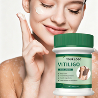 Krim Perawatan Vitiligo Logo Kustom Anda 30g, Cepat Menyerap, Lembut, Menyeimbangkan, Melembapkan, Meratakan Warna Kulit, Perawatan Efektif