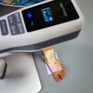 MSLXG03 alat bedah portabel, pencari Nadi inframerah pemindai Nadi medis genggam - Product Image 5