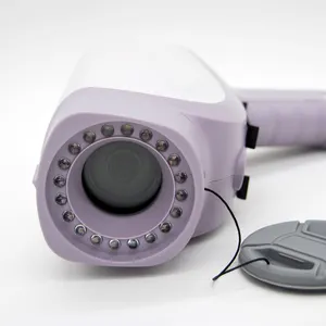Colposcope vidéo de beau vagin Portable kn2200ihd pour l'examen de gynécologie