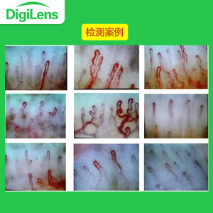 เครื่องตรวจจับการไหลเวียนโลหิตระดับไมโคร Godly Blood รุ่น DMX980-1 อุปกรณ์ถ่ายภาพเส้นเลือดฝอยบนเล็บระดับมืออาชีพ - Product Image 4