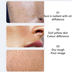 Prodotti cosmetici di bellezza cura della pelle del viso <span class=keywords><strong>biologica</strong></span> Niacinamide sbiancante schiarente detergente viso in schiuma rinfrescante per il controllo dell'olio - Product Image 4