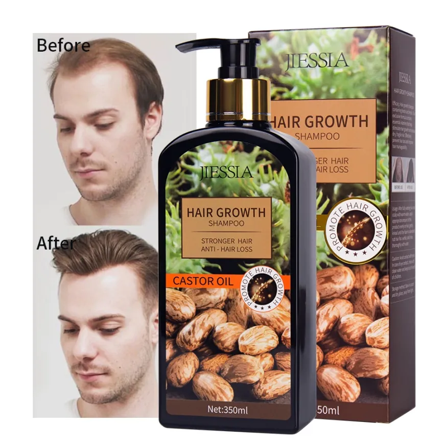 wholesale OEM private label custom logo castor oil hair regrowth shampoo