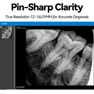 Capteur numérique haute définition à imagerie intra-orale à rayons X dentaire Eco-capteur I de taille 1.0/2.0 pour clinique dentaire ou vétérinaire - Product Image 2