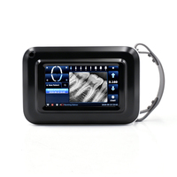 Appareil de radiographie dentaire portable VIMEL X avec écran tactile et capteur RVG numérique, système d'imagerie de diagnostic intelligent IA pour clinique