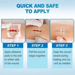 Dispositif de Fermeture d'Urgence Efficace pour Lacerations, Protection d'Urgence pour Fermeture de Plaies, Idéal pour les Activités de Plein Air - Product Image 4