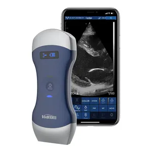 Viatom Wifi Ultrasound Probe Scanner Digital Sem Fio Máquina De Ultrassom Portátil De Terapia Humana