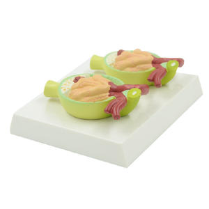 चिकित्सा शिक्षण उपकरण का विस्तार मानव प्रोटीनुरिया मॉडल गुर्दे मूत्र प्रोटीन पैथोलॉजिकल संरचना मॉडल - Product Image 1