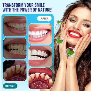 Enjuague bucal natural sin alcohol de etiqueta privada para el cuidado bucal Técnica de extracción de aceite Aceites de coco de menta de sésamo para dientes - Product Image 5