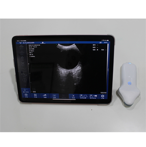 Draagbare Medische Ultrasone Machine Draagbare Zakformaat Draadloze Kleur Micro Convexe Sonde Usb + Wifi Draadloze Oog - Product Image 4
