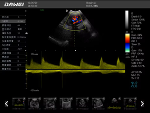 Máy siêu âm động vật sóng xung cho thai kỳ máy siêu âm xách tay chẩn đoán hỗ trợ thiết bị sinh sản - Product Image 5