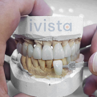 Bloque de Zirconia Multicapa Ivista UT-ML, 60% de Translucidez, 650 MPa, Directo de Fábrica, para Diseño de Carillas Dentales