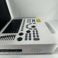 Appareil d'échographie portable, écran LCD couleur haute résolution de 15 pouces, système Windows 7, prise en charge de plusieurs sondes, certifié CE