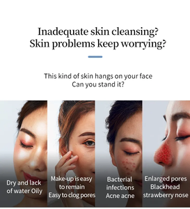 Điện bong bóng nhỏ mụn đầu đen Remover USB có thể sạc lại chu kỳ nước lỗ chân lông mụn trứng cá loại bỏ chân không hút mặt sạch hơn công cụ - Product Image 5