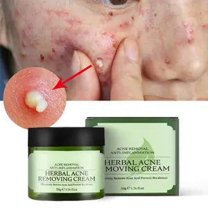 Private Label Pimples Dark Spot Remover Cream Herbal Acne Treatment Tea Tree Acne Pimple Removal Cream for All Skin Type