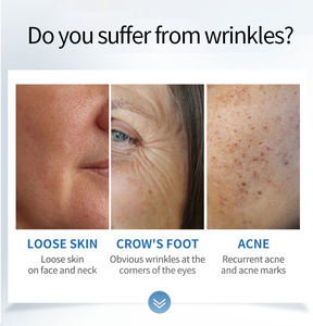 Dissolvant de rides 12d lifting peau serrant la machine d'élimination des rides 1470nm Diode Laser Machine - Product Image 4