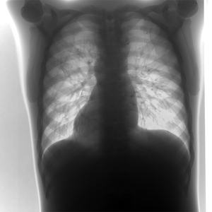 Máquina de Rayos X de Doble Columna <span class=keywords><strong>3D</strong></span> /50KW, Equipo de Diagnóstico por Imagen Radiográfica, Máquina de Rayos X DR - Product Image 5
