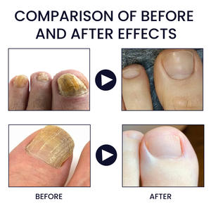 SOUTH MOON Gel per Pediluvio con Formula Erboristica per Disintossicazione del Corpo e Riparazione delle Funzioni Ungueali - Product Image 4