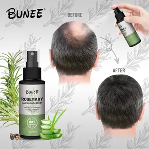 Low MOQ Rosemary Hair Regrowths Lotion Spray Serum Oil For Men And Women With Derma Roller