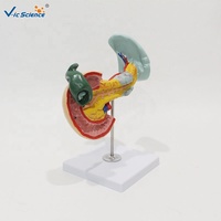Modelo de Simulación de Enfermedades Biliares y del Páncreas con Cálculos Biliares y Tumor de Pancreatitis para Entrenamiento Médico, con Certificaciones CE/ISO/ROHS/CNAS