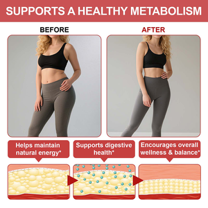 Solotree תווית פרטי תוספי תזונה טבעוני אובדן משקל 1000 ketto תפוחים חומץ גמילה חניכיים עם אמא - Product Image 3