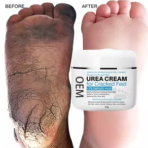 Oem Dom 40% Ureum Voetcrème Hydraterende Cutin Foot Cream Anti Crack Exfoliërende Intensief Voedende Hand En Voeten Crème