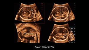Appareil d'échographie Mindray Nuewa I9 pour usage vétérinaire avec système d'imagerie diagnostique et échographie Doppler couleur Full HD - Product Image 5