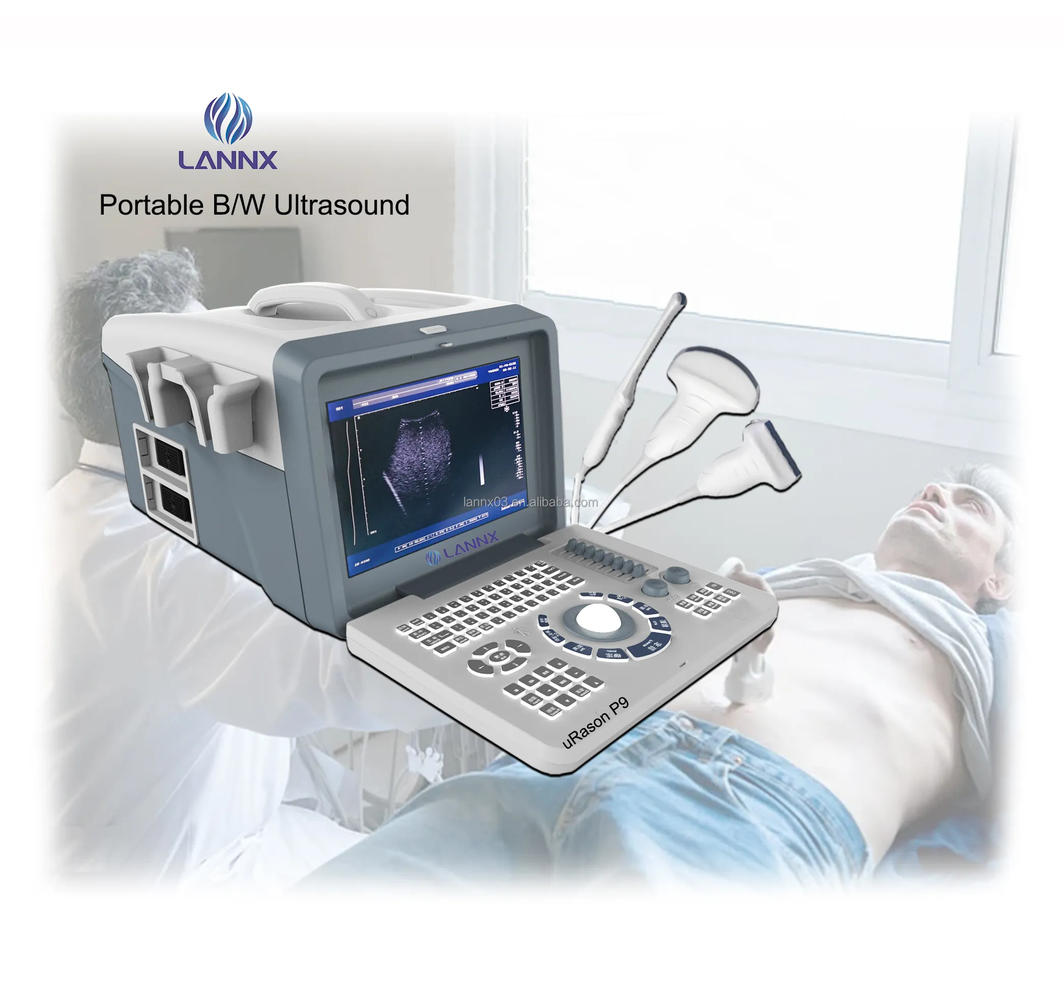 LANNX uRason P9 New products Portable Ecograph Digital Laptop Black and White pregnancy Ultrasound fetal ultrasound machine