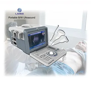 Lannx urason P9 Sản phẩm mới xách tay ecograph kỹ thuật số máy tính xách tay màu đen và trắng thai siêu âm thai nhi máy siêu âm