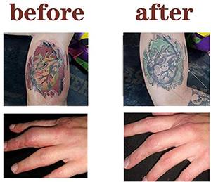 Ungüento para el Cuidado Posterior del Tatuaje WenShen, Suministro al por Mayor para Distribuidores, Crema Reparadora de Piel, Marca Privada OEM - Product Image 4