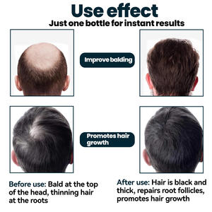 Sérum à base de plantes biologiques pour la repousse des cheveux, prévient la perte de cheveux, huile de croissance des cheveux pour hommes - Product Image 6