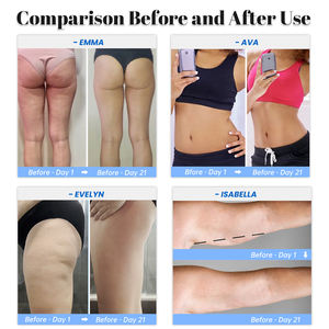 Masseur Électrique Anti-Cellulite <span class=keywords><strong>Cuisses</strong></span> Brûleur de Graisse Abdominale Dispositif Minceur <span class=keywords><strong>pour</strong></span> le Corps Anti-Cellulite <span class=keywords><strong>pour</strong></span> Faire Fondre la Graisse Usage Domestique - Product Image 5