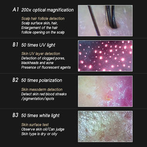 Meiboyi venda Quente Análise De Cabelo máquina home use pele analisador Cabelo Folículo Detector scanner do couro cabeludo Para Hair Beauty Salon - Product Image 5