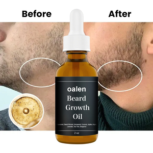 Huile pour barbe Label Men, favorise la croissance de la barbe, renforce les racines, huile pour moustache, essences biologiques, non parfumée, tenue forte, tous âges - Product Image 2