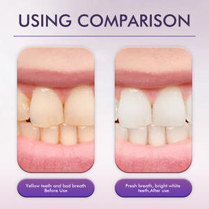 Dentifrice de sérum de blanchiment des dents violette de 30ml de marque privée pour la restauration des dents et le nettoyage buccal - Product Image 4