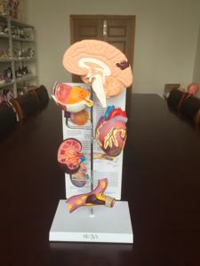 Modelo Anatómico de Cerebro Humano en Escala 1:1 de PVC con Modelo de Anatomía Patológica Hipertensiva - Product Image 2