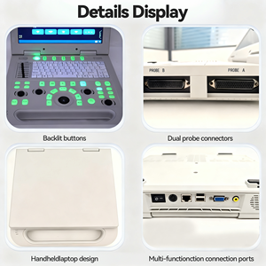 Equipo Dental Karestar K-H109A, Sistema de Ultrasonido Veterinario Portátil 3D, Múltiples Sondas, Ecológico, con Certificación CE - Product Image 4