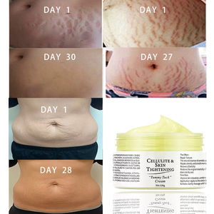 Crème de Réparation Cutanée Maternité en Gros, Élimination des Cicatrices Corporelles de Grossesse OEM, Crème Anti-Vergetures Marque Privée - Product Image 5