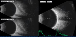 Eye <strong>Scan</strong> Ophthalmic <strong>AB</strong> Ultrasound Scanner Ophthalmic Equipment <strong>AB</strong> <strong>Scan</strong> - Product Image 5