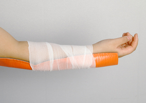 Attelle moulable compatible aux rayons X pour l'immobilisation du bras, de la jambe, du poignet et de la cheville, attelle roulante - Product Image 3